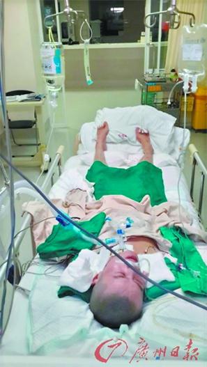 在医院ICU病房中的张俊。