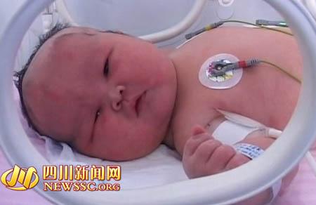 蔼闹玻包玻12.5捆 骸玂絚(瓜)