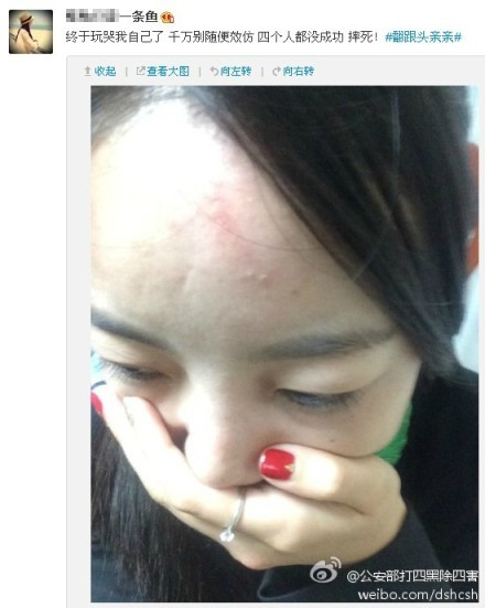 “翻跟头亲亲”网络爆红 网友模仿受伤[组图]