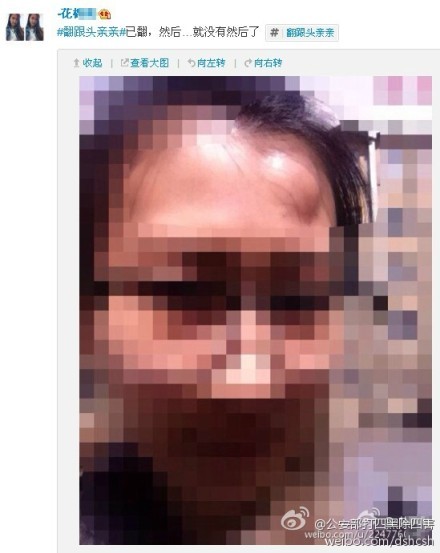 “翻跟头亲亲”网络爆红 网友模仿受伤[组图]
