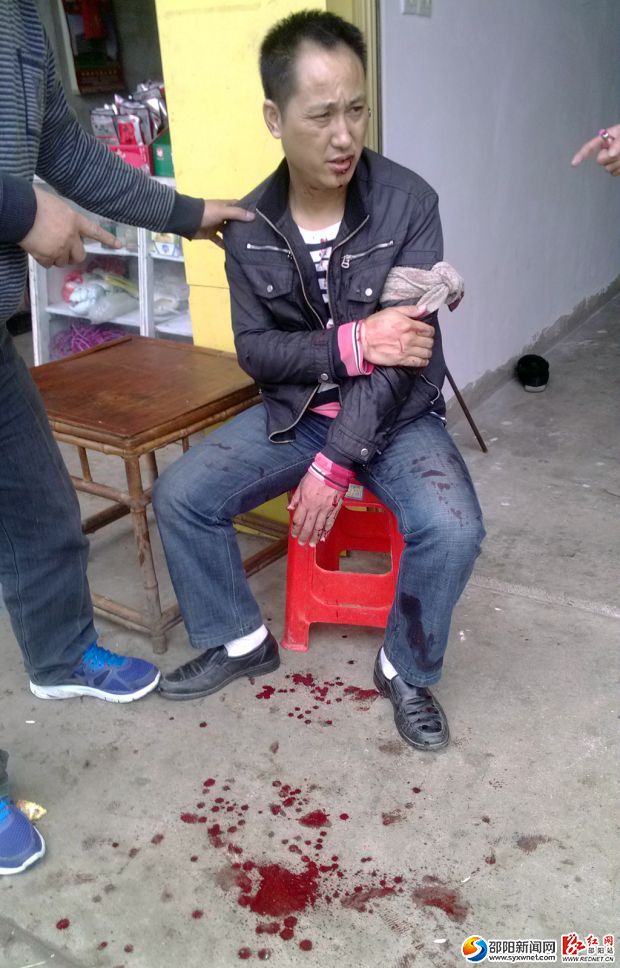 刘师傅当时被捅伤现场(该图由刘师傅提供)