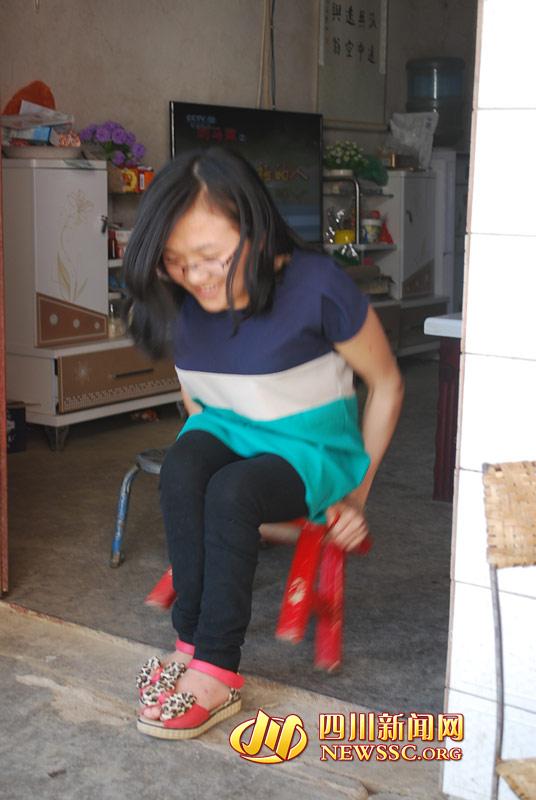 女孩患脆骨病曾骨折30多次 以板凳代步(图)