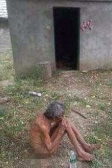 九旬失明老太被指无人照顾 光着身子两脚生蛆
