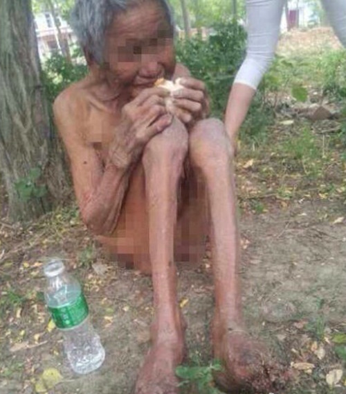 九旬失明老太被指无人照顾 光着身子两脚生蛆