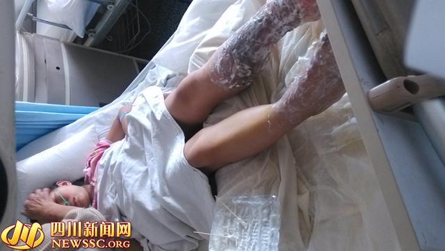 市民点蚊香引燃沙发 10岁女孩被烧伤(图)