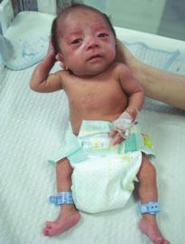 “手掌宝宝”出院时体重已经翻番