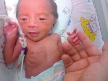 宝宝出生时和成人手掌差不多大