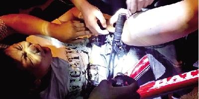 男孩骑自行车发生侧翻 刹车把手刺入大腿13厘米