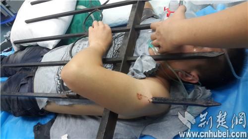 男子为抄近路翻围墙 整个左臂被铁栅栏戳穿(图)