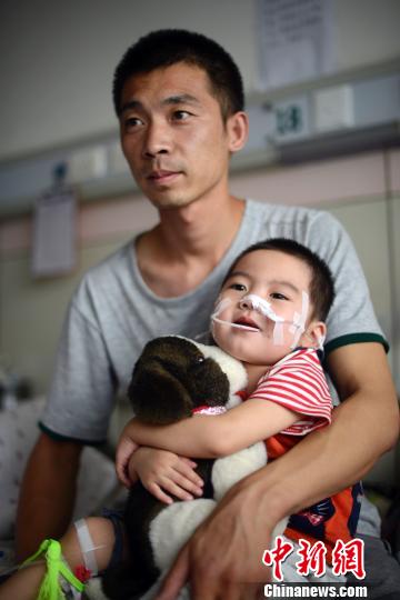山西父亲嘴对嘴喂食女儿500天患儿顺利手术（图）