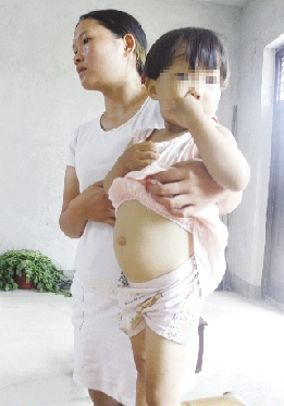 原标题:3岁小女孩身患地中海贫血症,每月靠输血续命