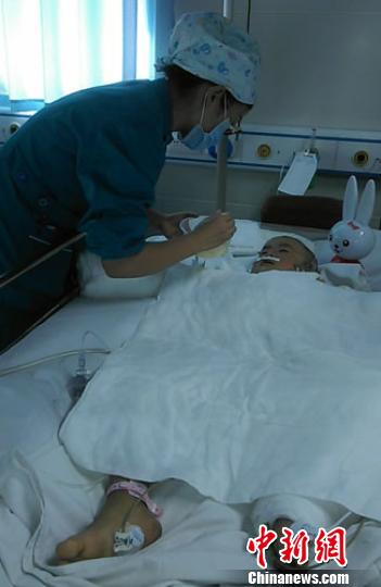 医护人员在重症监护室里护理黄子浵。 资料图 摄