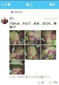 汕头男子为胁迫家人给赌资暴打儿子发照片(图)
