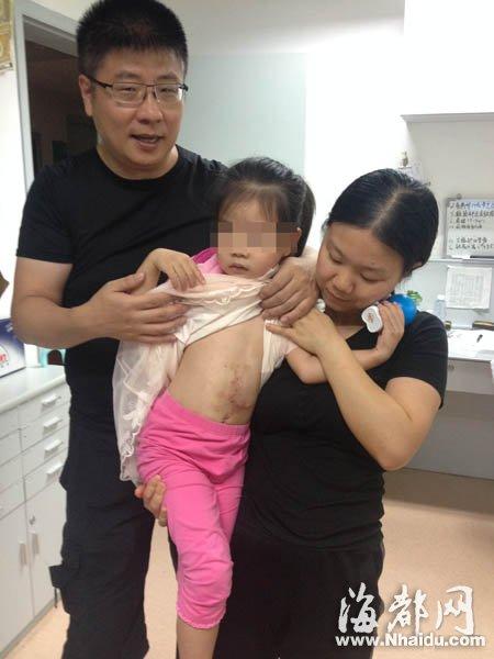 女童先天五脏六腑裸露 做3次手术成功修复(图)