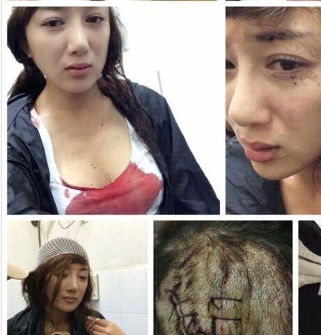 被咬女星李晓依