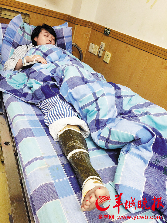杨小姐的右腿被蛇咬伤，目前仍在住院
