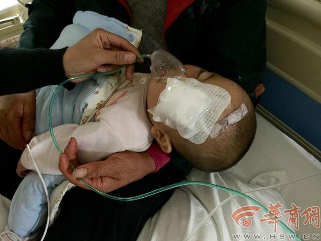 学走路被公鸡啄伤 1岁女童左眼球破裂视力难恢复