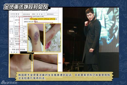 金贤重涉嫌殴打女友