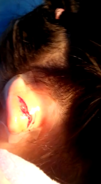 7岁女童因答问题声小被老师扯烂耳朵