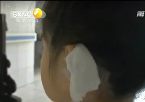 7岁女童因答问题声小被老师扯烂耳朵