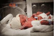 印度“女子”产下双胞胎95%染色体为男性（图）