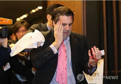 美国驻韩大使遭袭击受伤 嫌疑人已被警方逮捕