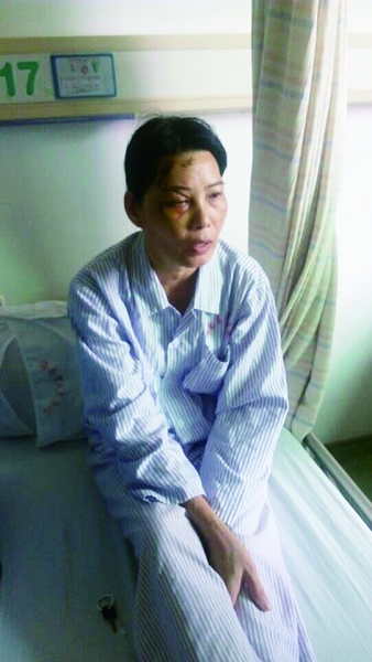 周女士的右眼还睁不开