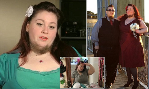 美国女子蓄胡须多年丈夫不离不弃对其鼓励（图）