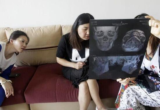 郑州大四女生颜值低被嘲讽 瞒家人整形怕死在手术台