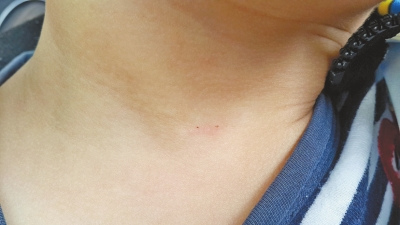 河科大幼儿园3岁半男童因推倒小朋友被老师针刺