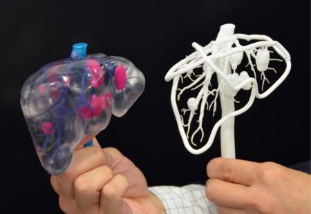日本研发3D打印肝脏模型法血管等清晰可见（图）