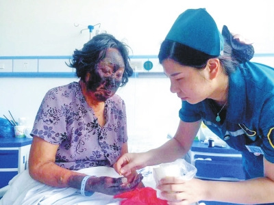 河南老太吃苋菜后面如刷黑漆皮肤坏死需植皮（图）