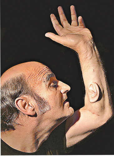 澳男子手臂上移植“耳朵”还欲将其连接上网(图)