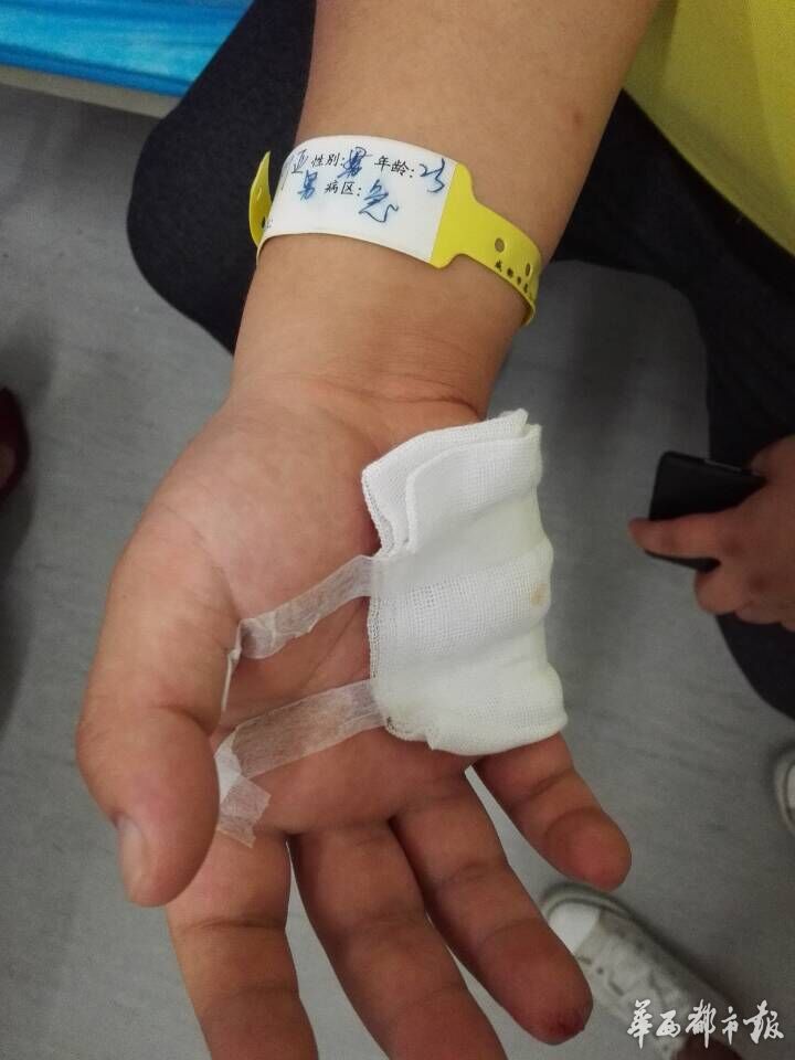 成都闹市电缆掉落 3人被砸1人手掌骨折(图)