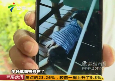 女子被闪电击中,炸烂短裤灼烧双乳只因内衣带钢圈