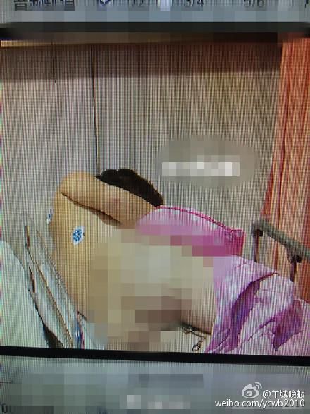 痔疮疼痛难忍 男子把刀插进屁股