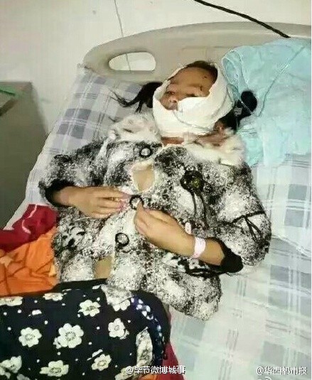 被咬女孩