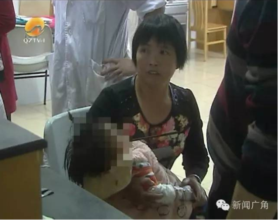 福建1岁女童摔倒在地 手中筷子从嘴里插入颅底