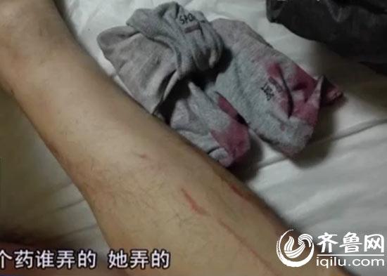 小伙手指断裂身中“百草枯” 或因前女友报复