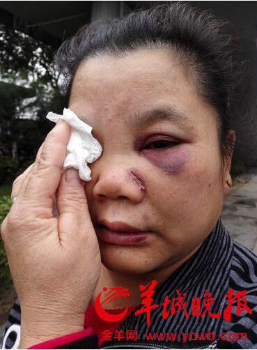 环卫工阻止行人踢垃圾被打 一脸血晕倒在地