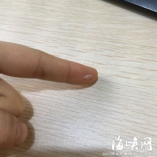玻璃碴米粒大小（当事网友微博图）