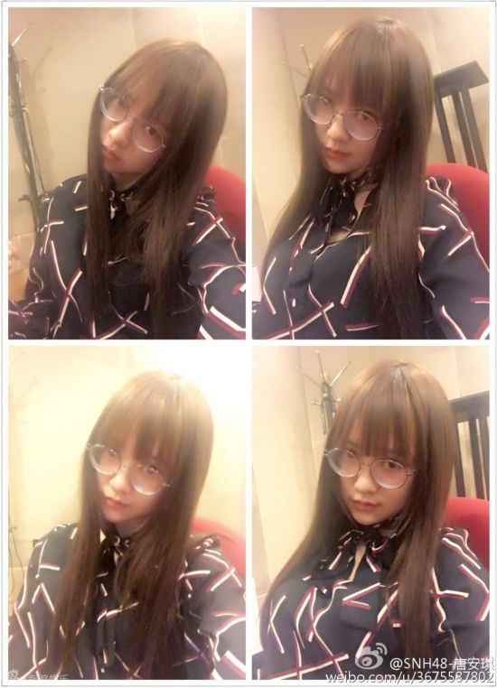 组图：SNH48唐安琪严重烧伤 私照甜美清纯