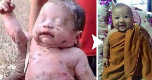 被刺14刀脸朝下活埋 泰国“奇迹宝宝”长大了(图)