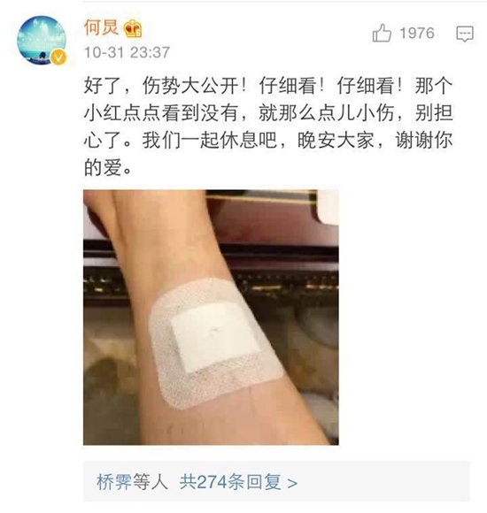 何炅晒细节图安慰粉丝