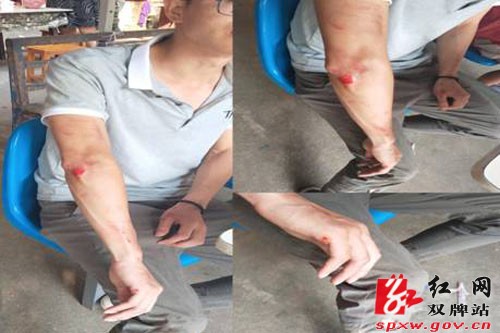 扶贫路上：轻伤不下火线 森林土鸡暖民心