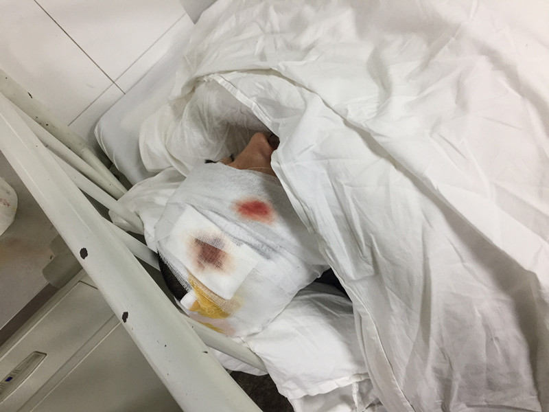 樊昊仑路演车祸医院照泄露 疑遭毁容纱布遮面