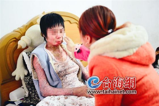 女子被已婚男纠缠泼汽油烧伤汶川地震曾逃生