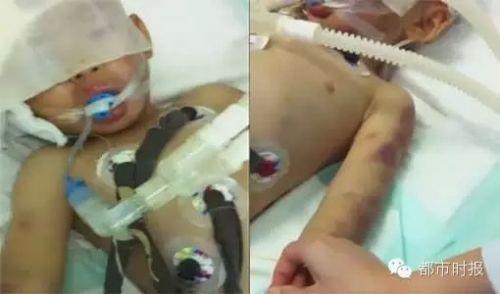 12月19日下午6:20,3岁男孩普谨瑜的生命定格在了这个时刻.